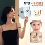 VEVOR LED-Gesichtsmaske 7 Farben Lichttherapie mit 850 nm NIR Anti-Aging-Falten