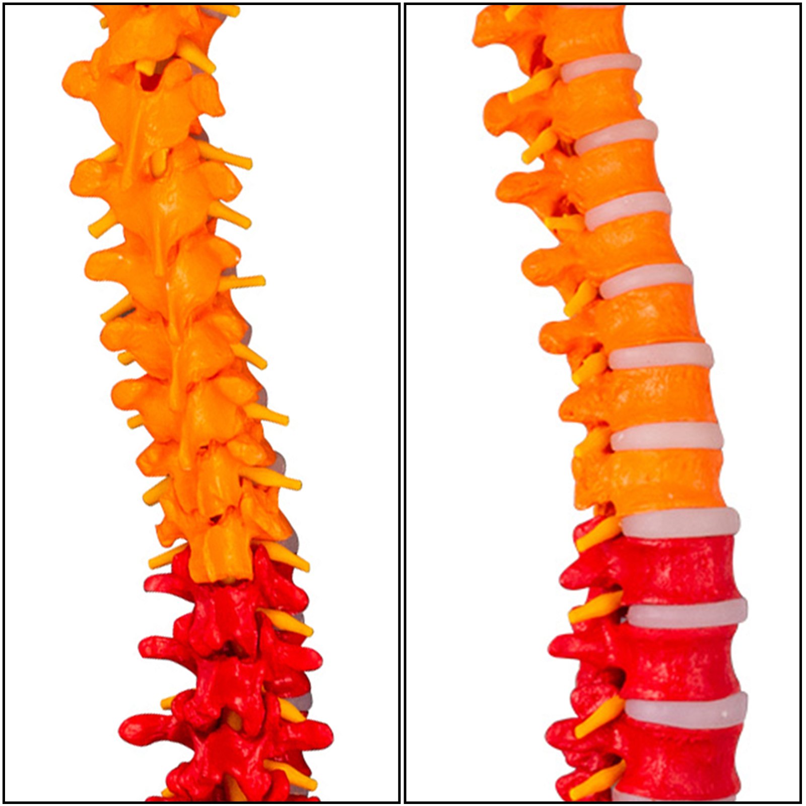 Modelo De Columna Vertebral Esquelética 85cm Soporte Resistente