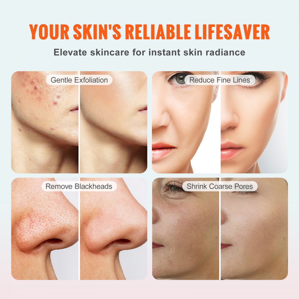 VEVOR Máquina de microdermoabrasión de diamante, máquina de dermoabrasión profesional 3 en 1, equipo de cuidado de la piel facial para salón de spa en casa, con 9 puntas de diamante, 2 botellas de spr